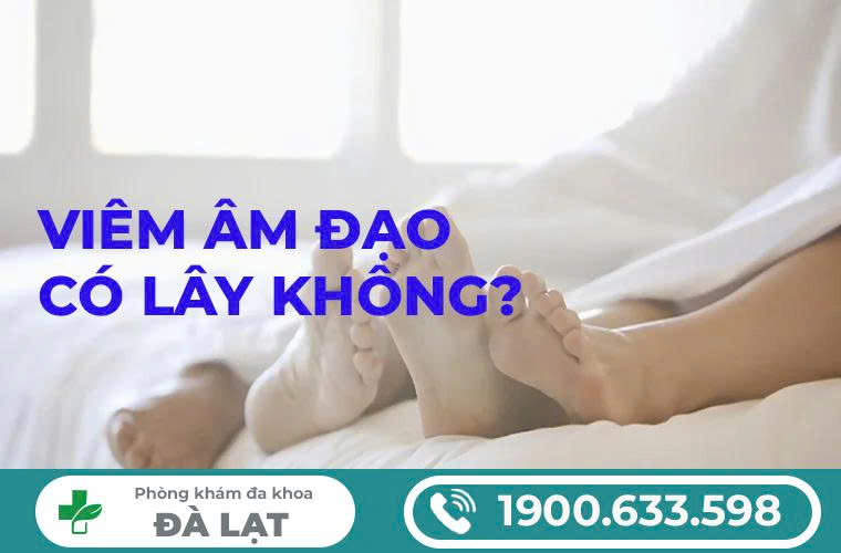 Hình ảnh minh họa